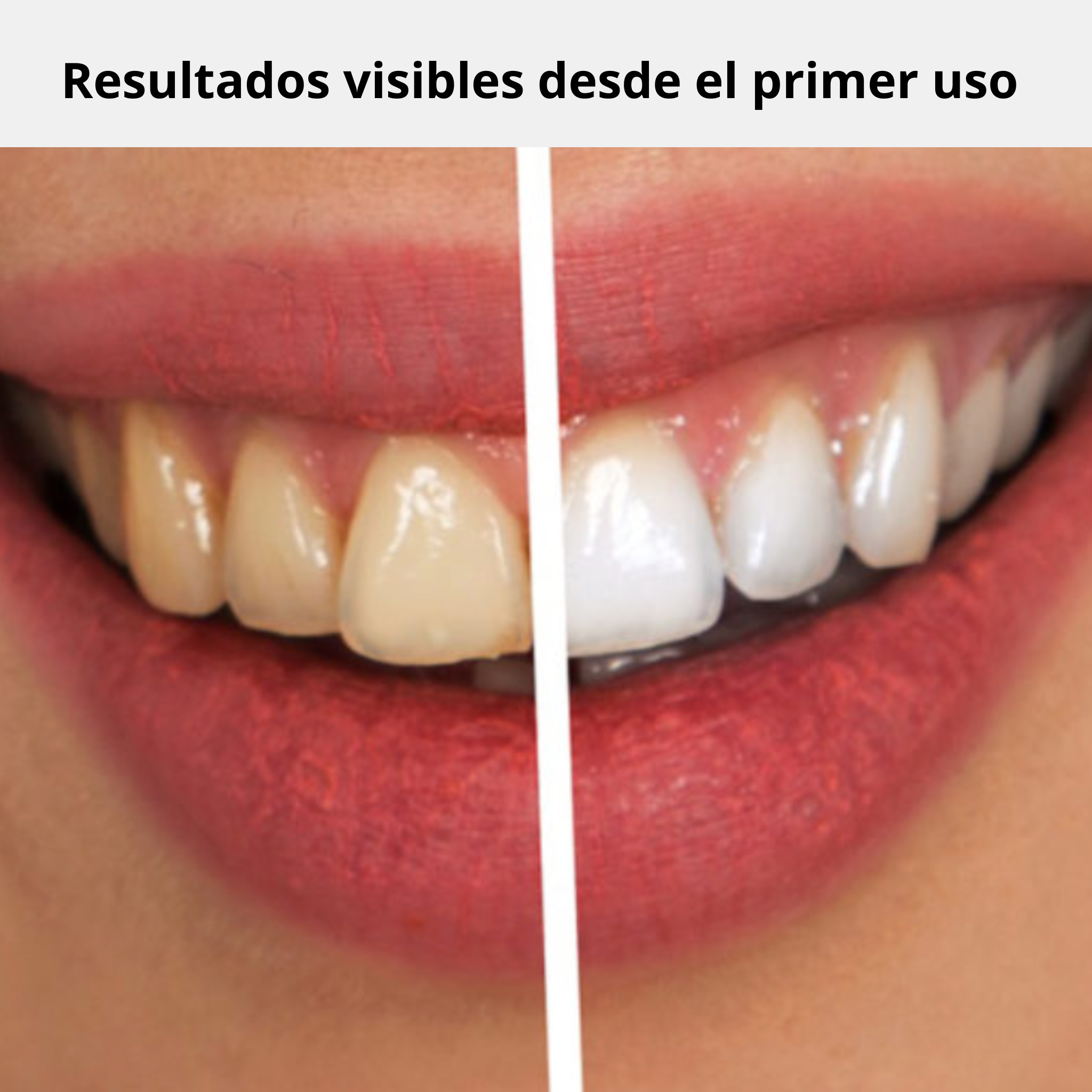 Blanqueador instantáneo para dientes NaturLab®