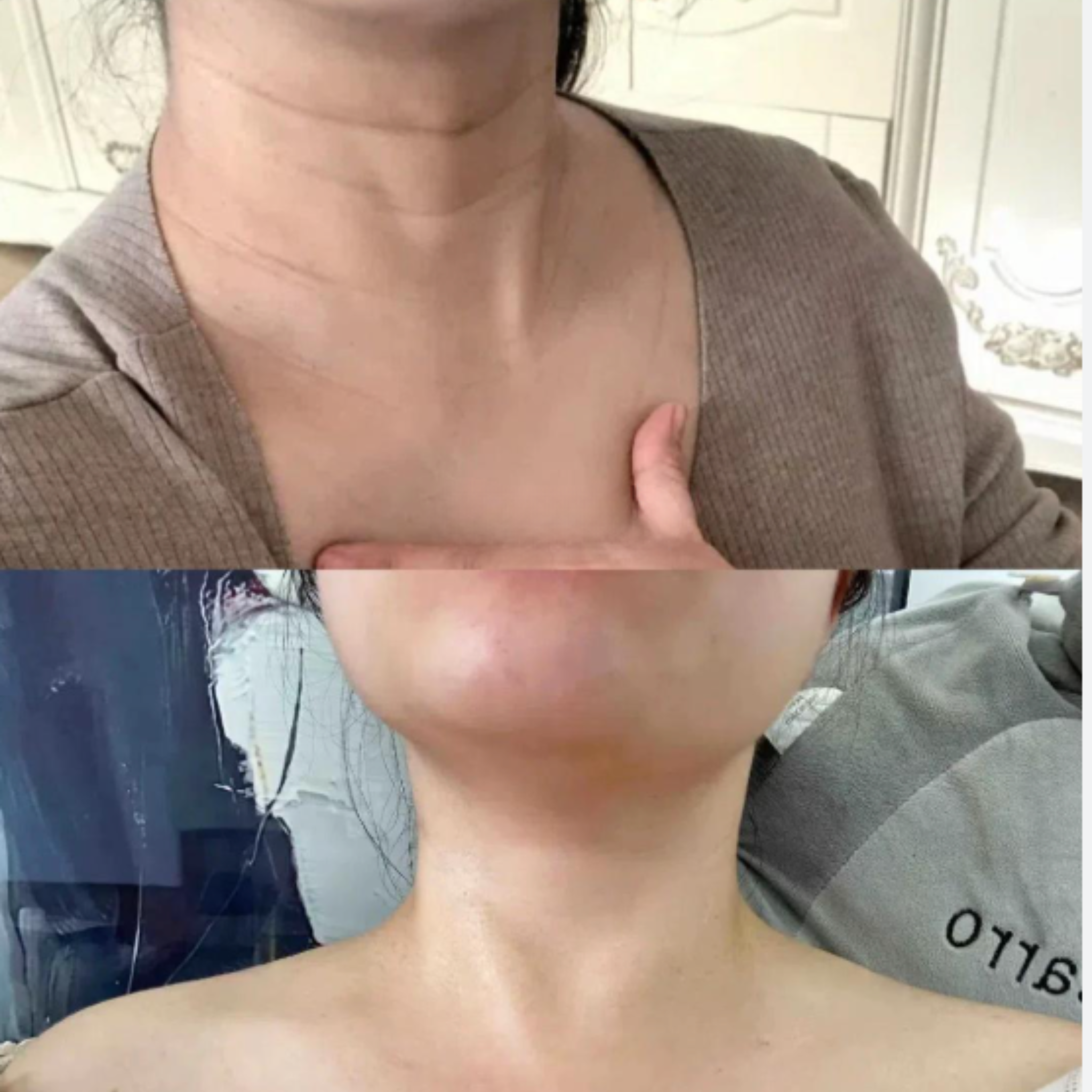 Crema de cuello NaturLab ®-  Reafirma tu cuello y recupera tu confianza