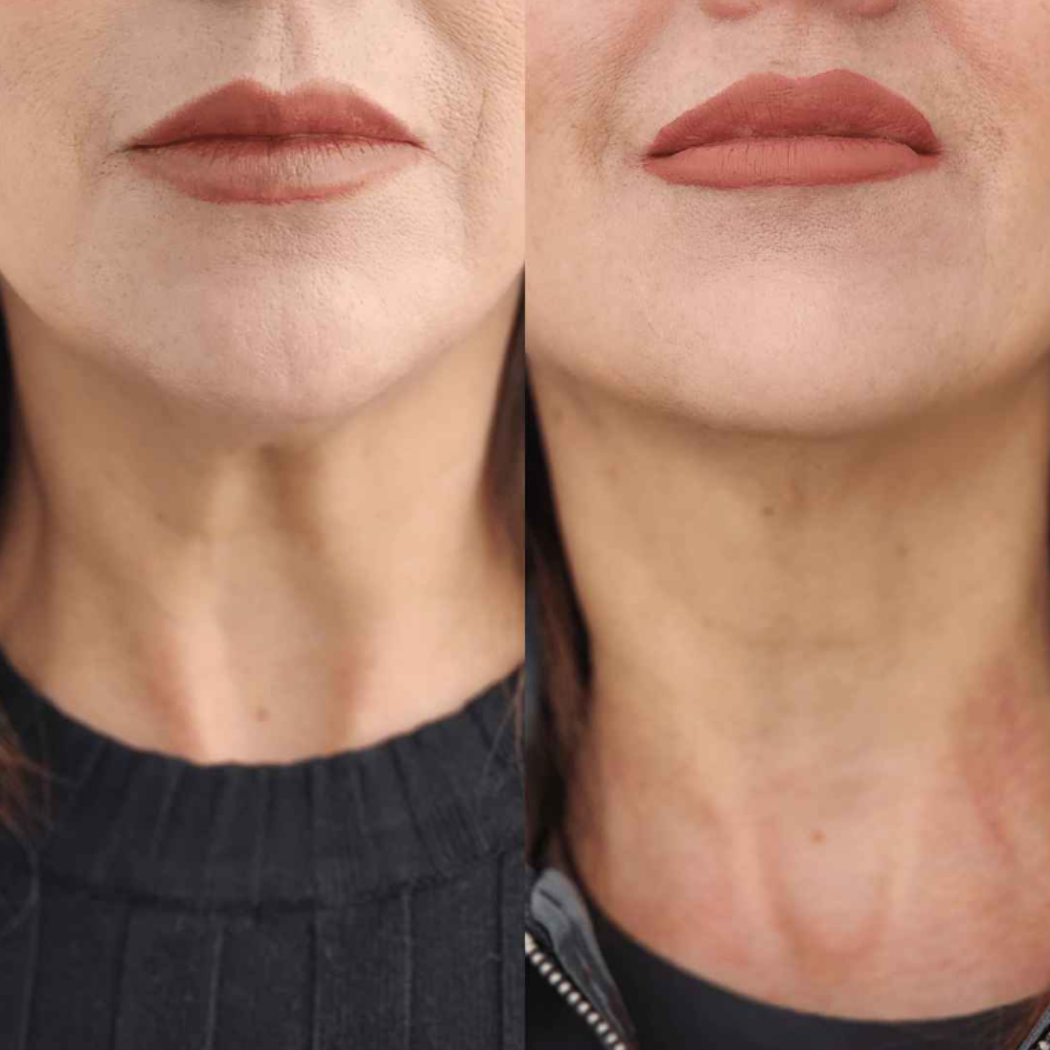 Crema de cuello NaturLab ®-  Reafirma tu cuello y recupera tu confianza