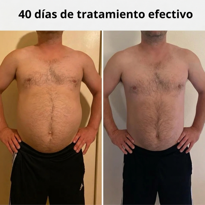 Liquid Lymphatic Drainage - Reduces swelling and helps you regain your figure