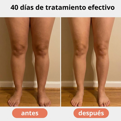 Drenaje Linfático Líquido - Reduce la hinchazón de piernas y siéntete más ligera